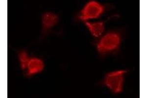 ABIN6277893 staining Hela by IF/ICC. (ERN1 anticorps  (Internal Region))