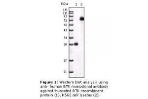 Image no. 2 for anti-Bruton Agammaglobulinemia tyrosine Kinase (BTK) antibody (ABIN232137) (BTK anticorps)