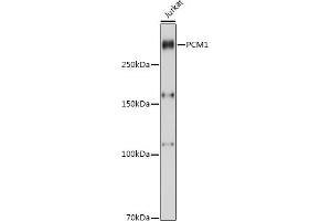 Western blot analysis of extracts of Jurkat cells, using PCM1 antibody (ABIN7269217) at 1:1000 dilution. (PCM1 anticorps  (AA 1-260))