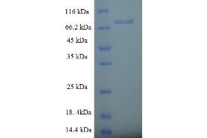 SDS-PAGE (SDS) image for RAB Guanine Nucleotide Exchange Factor (GEF) 1 (RABGEF1) (AA 1-491), (full length) protein (His-SUMO Tag) (ABIN5711903)