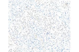 Immunohistochemistry (IHC) image for anti-Zinc Finger CCCH-Type Containing 4 (ZC3H4) (AA 1050-1100) antibody (ABIN7795761)
