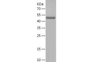 Western Blotting (WB) image for Proopiomelanocortin (POMC) (AA 27-267) protein (His-IF2DI Tag) (ABIN7124600) (POMC Protein (AA 27-267) (His-IF2DI Tag))