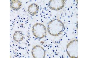 Immunohistochemistry of paraffin-embedded Human stomach using CABP7 Polyclonal Antibody at dilution of 1:100 (40x lens). (CABP7 anticorps)