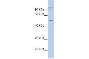 GJA3 antibody used at 1 ug/ml to detect target protein. (GJA3 anticorps  (N-Term))