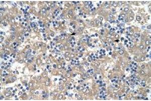Immunohistochemical staining (Formalin-fixed paraffin-embedded sections) of human liver with C3orf10 polyclonal antibody  at 4-8 ug/mL working concentration. (BRK1 anticorps  (Internal Region))