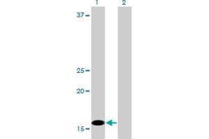 Western Blotting (WB) image for anti-C1D Nuclear Receptor Corepressor (C1D) (AA 1-142) antibody (ABIN599137) (C1D anticorps  (AA 1-142))