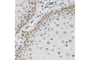 Immunohistochemistry of paraffin-embedded human esophagus using TGM2 antibody (ABIN5970369) (40x lens).