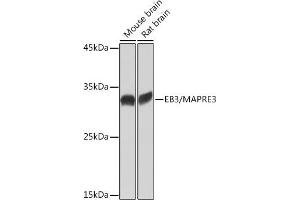 Western blot analysis of extracts of various cell lines, using EB3/M Rabbit mAb (ABIN7268535) at 1:1000 dilution. (MAPRE3 anticorps)