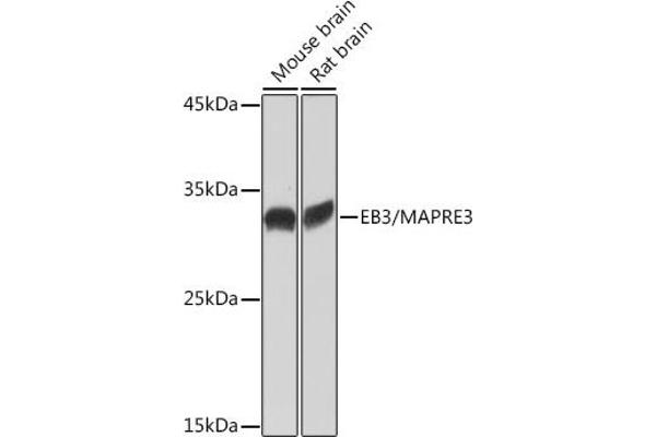 MAPRE3 anticorps
