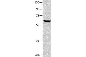 Western blot analysis of Human seminoma tissue, using DNAJC7 Polyclonal Antibody at dilution of 1:400 (DNAJC7 anticorps)