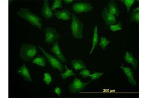 Immunofluorescence of monoclonal antibody to EIF4G1 on HeLa cell.