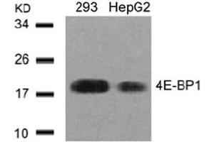 Image no. 3 for anti-Eukaryotic Translation Initiation Factor 4E Binding Protein 1 (EIF4EBP1) (AA 43-47) antibody (ABIN197452) (eIF4EBP1 anticorps  (AA 43-47))