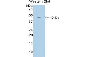 Detection of Recombinant C3a, Mouse using Polyclonal Antibody to Complement Component 3a (C3a) (C3a anticorps  (AA 671-748))