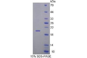 SDS-PAGE analysis of Mouse Interleukin 7 Receptor Protein.