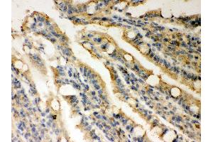 Anti- Rad51 Picoband antibody, IHC(P) IHC(P): Rat Intestine Tissue