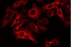 ABIN6266638 staining LOVO by IF/ICC. (Synaptophysin anticorps  (Internal Region))