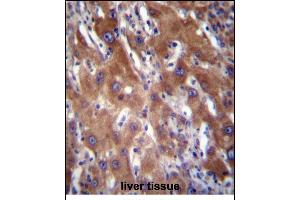 GNE Antibody (N-term) (ABIN656219 and ABIN2845536) immunohistochemistry analysis in formalin fixed and paraffin embedded human liver tissue followed by peroxidase conjugation of the secondary antibody and DAB staining. (GNE anticorps  (N-Term))