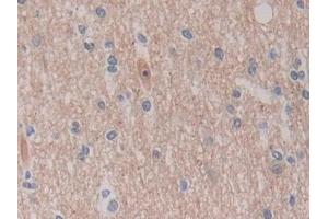 Detection of ROS1 in Human Cerebrum Tissue using Polyclonal Antibody to C-Ros Oncogene 1, Receptor Tyrosine Kinase (ROS1) (ROS1 anticorps  (AA 1945-2222))