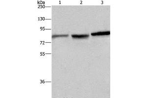 Western Blot analysis of Mouse brain tissue, A172 and Hela cell using DBH Polyclonal Antibody at dilution of 1:200