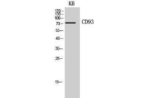 Western Blotting (WB) image for anti-CD93 (CD93) (Internal Region) antibody (ABIN3178943) (CD93 anticorps  (Internal Region))