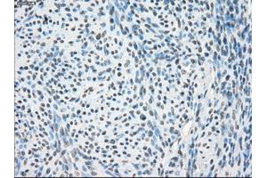 Immunohistochemical staining of paraffin-embedded Kidney tissue using anti-PPP5Cmouse monoclonal antibody. (PP5 anticorps)