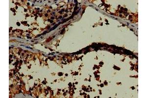 Immunohistochemistry of paraffin-embedded human testis tissue using ABIN7157798 at dilution of 1:100 (Lactate Dehydrogenase C anticorps  (AA 2-332))