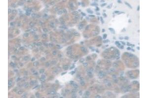 Detection of GLP1R in Mouse Stomach Tissue using Polyclonal Antibody to Glucagon Like Peptide 1 Receptor (GLP1R)