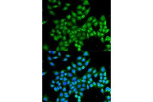 Immunofluorescence analysis of MCF-7 cells using DAO antibody. (D Amino Acid Oxidase anticorps)