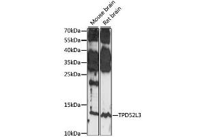 Western blot analysis of extracts of various cell lines, using TPD52L3 antibody (ABIN7271079) at 1:1000 dilution. (TPD52L3 anticorps  (AA 1-132))