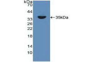 Western blot analysis of recombinant Human RELB. (RELB anticorps  (AA 248-492))