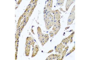 Immunohistochemistry of paraffin-embedded human esophageal smooth muscle using MRPL12 antibody at dilution of 1:100 (x40 lens). (MRPL12 anticorps)