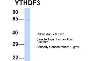 Host: Rabbit  Target Name: YTHDF3  Sample Tissue: Human Adult Placenta  Antibody Dilution: 1. (YTHDF3 anticorps  (N-Term))