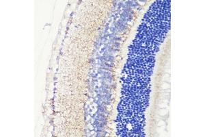 Immunohistochemistry of paraffin-embedded mouse retina using CRB1 antibody (ABIN7266524) at dilution of 1:200 (40x lens). (CRB1 anticorps  (AA 20-200))