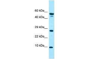 WB Suggested Anti-GGNBP1 Antibody Titration: 1. (GGNBP1 anticorps  (N-Term))