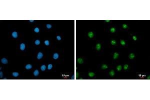 ICC/IF Image c-Myc antibody detects c-Myc protein at nucleus by immunofluorescent analysis. (c-MYC anticorps  (Center))