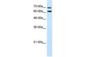 Image no. 2 for anti-Family with Sequence Similarity 55, Member D (FAM55D) (AA 407-456) antibody (ABIN205071) (FAM55D anticorps  (AA 407-456))