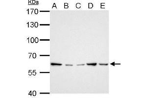 WB Image GGT1 antibody detects GGT1 protein by Western blot analysis. (GGT1 anticorps)