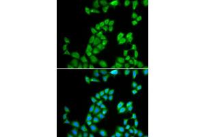 Immunofluorescence analysis of MCF-7 cell using RNASE13 antibody.