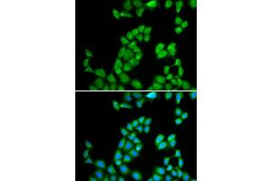 Immunofluorescence analysis of MCF-7 cell using RNASE13 antibody. (RNASE13 anticorps  (AA 1-156))