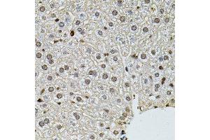 Immunohistochemistry of paraffin-embedded mouse liver using PNKP antibody.