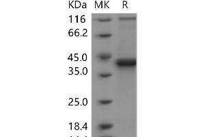 Western Blotting (WB) image for S100 Calcium Binding Protein B (S100B) (Active) protein (Fc Tag) (ABIN7320084)