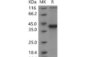 Western Blotting (WB) image for S100 Calcium Binding Protein B (S100B) (Active) protein (Fc Tag) (ABIN7320084) (S100B Protein (Fc Tag))
