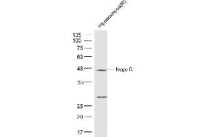 Rat Hippocampus lysates probed with Nogo Receptor Polyclonal Antibody, Unconjugated  at 1:500 dilution and 4˚C overnight incubation. (RTN4R anticorps  (AA 151-350))