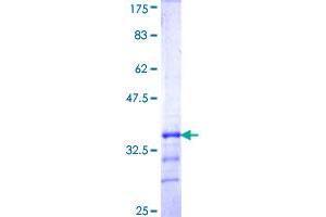 Image no. 1 for Potassium Inwardly-Rectifying Channel, Subfamily J, Member 15 (KCNJ15) (AA 290-355) protein (GST tag) (ABIN1308443)