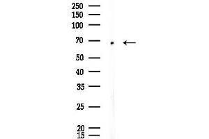 anti-Centrosomal Protein 72kDa (CEP72) antibody