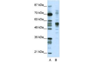 WB Suggested Anti-CORO1A  Antibody Titration: 1.