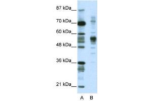 WB Suggested Anti-CORO1A  Antibody Titration: 1. (Coronin 1a anticorps  (C-Term))