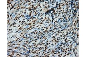 Immunohistochemistry (IHC) image for anti-Proteasome (Prosome, Macropain) 26S Subunit, ATPase, 3 (PSMC3) antibody (ABIN1501335)