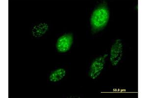 Immunofluorescence of purified MaxPab antibody to SCML1 on HeLa cell. (SCML1 anticorps  (AA 1-208))