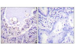 Immunohistochemistry (IHC) image for anti-V-Raf-1 Murine Leukemia Viral Oncogene Homolog 1 (RAF1) (Ser621) antibody (ABIN1847970) (RAF1 anticorps  (Ser621))